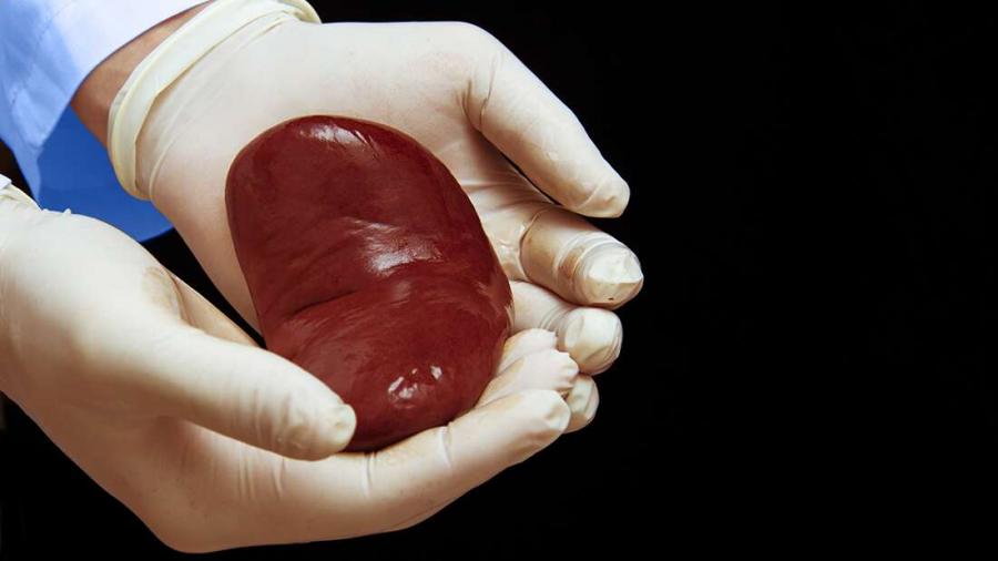 pig_kidney.jpg