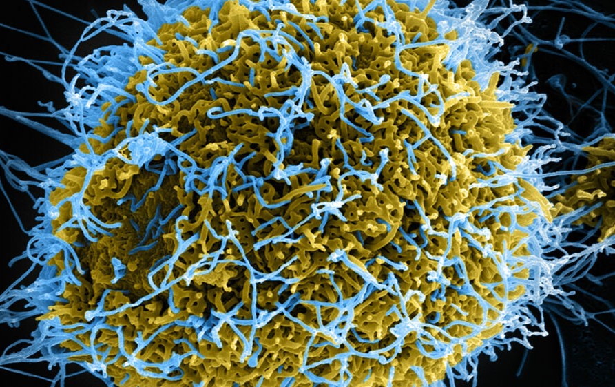 virus1.jpg